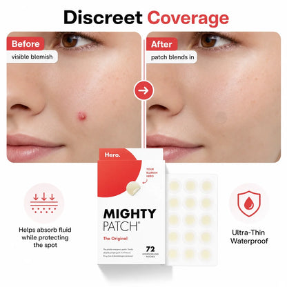 Hydrocolloid Acne Pimple Patches – Invisible Spot Treatment for Face